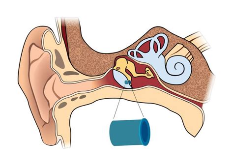 Ear Tubes - Mississippi Ear Nose & Throat Surgical Associates