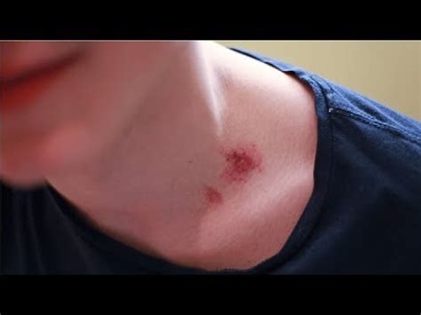 how to give someone a hickey on the neck - YouTube