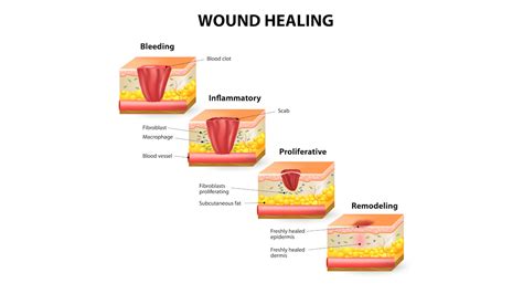 T.I.M.E wound assessment - Sergio Mazzei