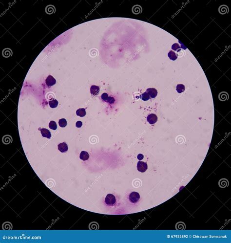 Mesothelial cells stock photo. Image of marrow, lymphocyte - 67925892