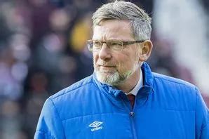 Craig Levein - Latest News, Gossip, Pictures & Videos - Daily Star