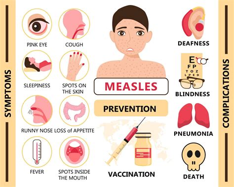 Measles infographic concept vector. Infected boy with papules on the ...