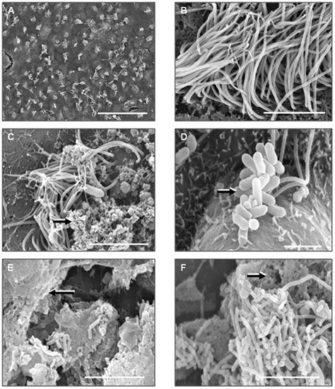 Scanning electron microscope images of Listeria on ciliated ependymal... | Download Scientific ...