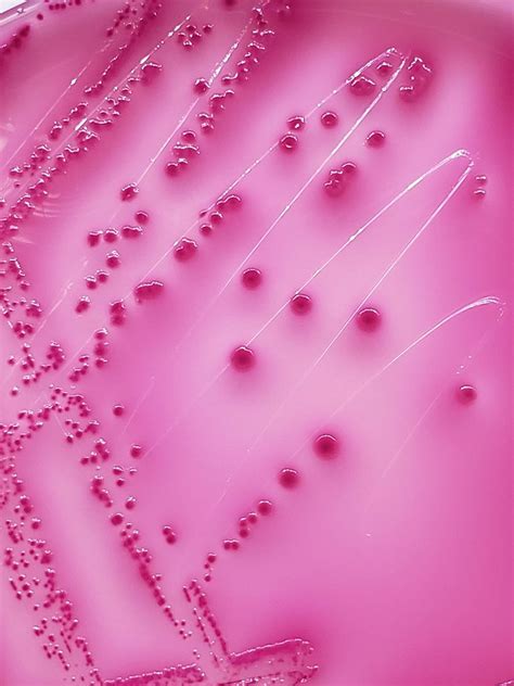 E. coli on MacConkey agar | Lactose fermenting colonies of E… | Flickr