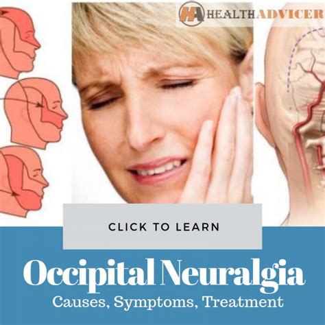 Occipital Neuralgia: Causes, Picture, Symptoms And Treatment