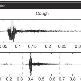 (PDF) Arnold's nerve cough reflex: Evidence for chronic cough as a ...