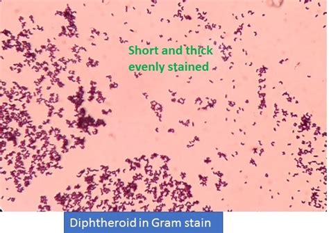 Diphtheroids in gram stain: Introduction, list of diphtheroids and their