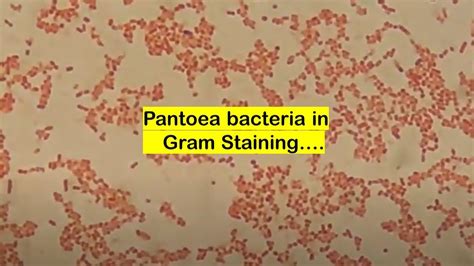 Pantoea in Gram Staining - YouTube