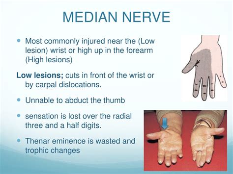 PPT - Peripheral Nerve Injuries PowerPoint Presentation, free download ...