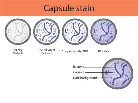 Capsule Stain - Its Principle, Reagents, Procedure, and Results