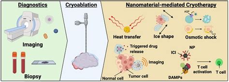 Recent progress in cryoablation cancer therapy and nanoparticles ...