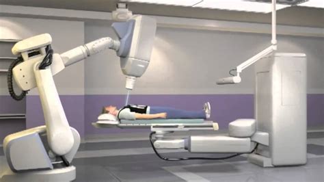 CyberKnife® Radiation Therapy for Lung Cancer Patients - YouTube