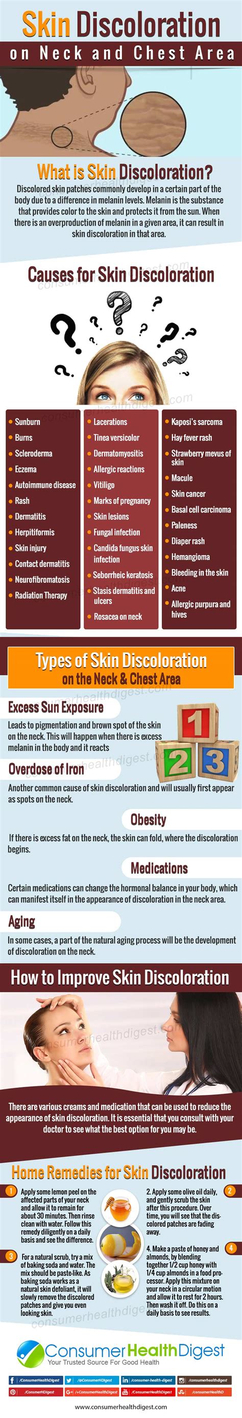 Skin Discoloration On Neck