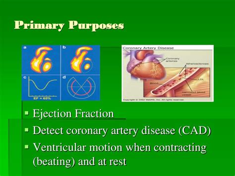 PPT - What is a MUGA scan? PowerPoint Presentation, free download - ID:4381464