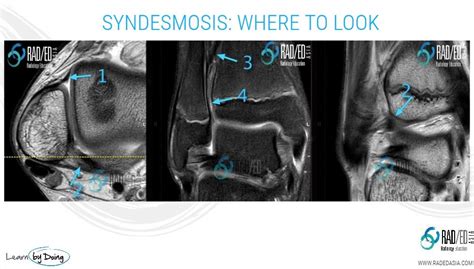 ANKLE QUIZ 05 – Radiology Education Asia