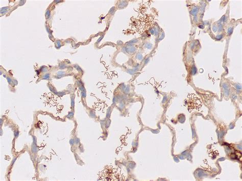 Spirochete Treponema Histology Slides, Artificial