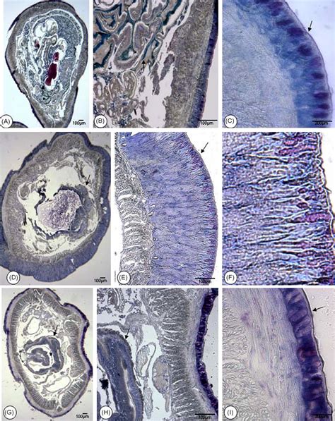 Photomicrographs of adult earthworm body parts, anterior end (A–C ...