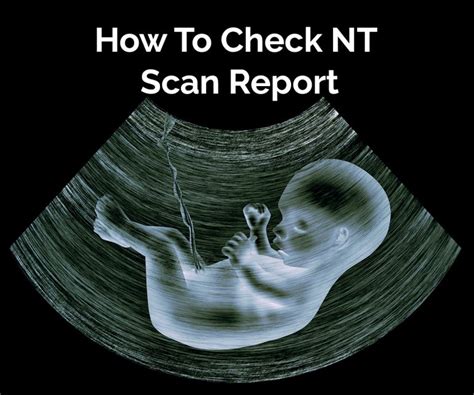 3 Month NT Scan Report Explained: Valuable Insights to Read Results