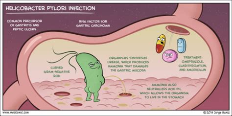 The truth about H. pylori infections and functional medicine - Podcast #90