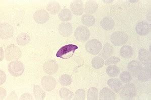 Free picture: thin, film, blood smear, micrograph, band, form, plasmodium malariae, trophozoite