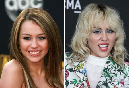 Are Miley Cyrus’ Teeth Real or Fake? | Longevita