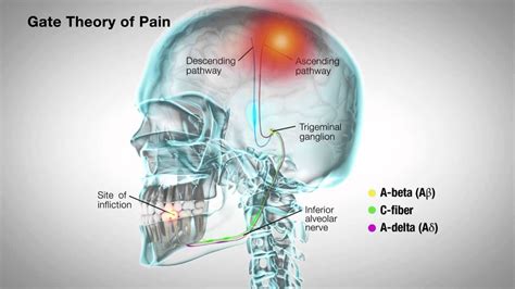 Hypoalgesia - YouTube