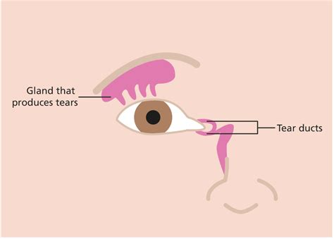 Blocked tear ducts (NLDO) - Resource Library - Sheffield Children's NHS ...