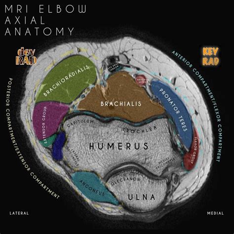 The next post in the anatomy series from @drdevrad and @keyradiologist ...