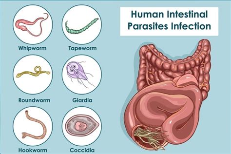 Whipworm Infections: Causes, Symptoms, and Treatments - Facty Health