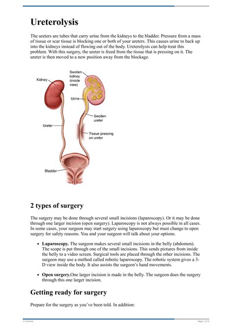 Text - Ureterolysis - HealthClips Online