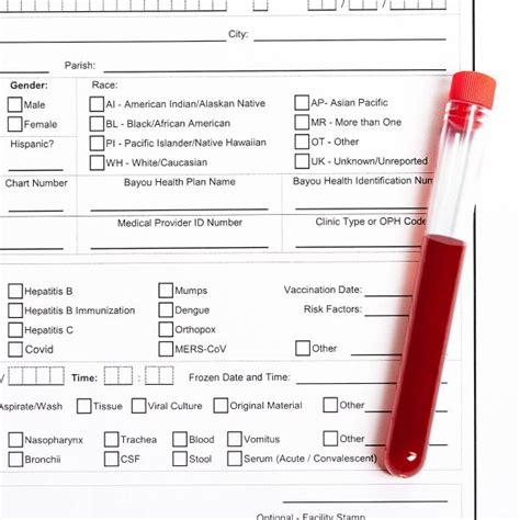 PTH, Parathyroid Hormone – Test Smartly Labs