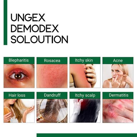 Skin Demodex Treatment | Acne Rosacea | Ungex Solution