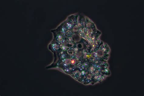 amoeba | under a microscope with 400x magnification. | pitschuni | Flickr