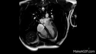 Cardiac MRI scan shows a heartbeat in high resolution on Make a GIF
