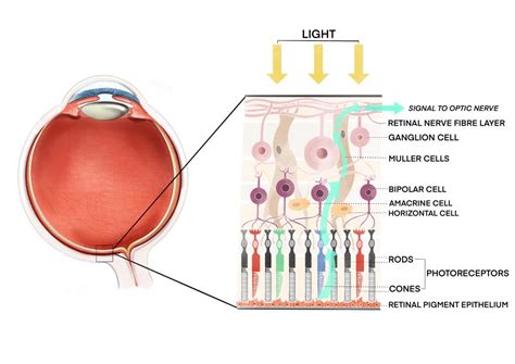 Cone/Cone-rod dystrophy: for patients - Gene Vision