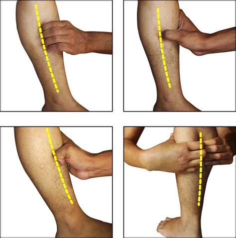 My Experience With Sciatica, page 3