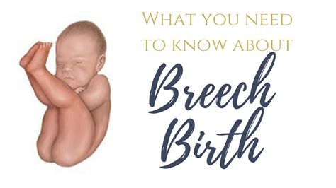 Breech Birth: What do you need to know? - Balanced Birth Support