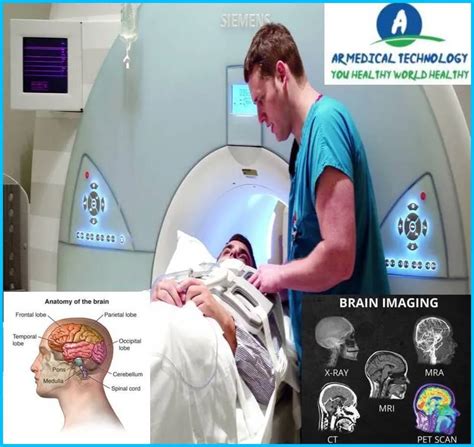 MRI Vs CT Scan Brain Best Way To Learn 24 AR Medical Technology