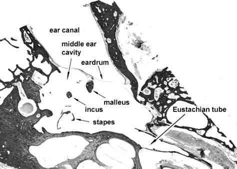 A typical histological section image of human temporal bone. | Download Scientific Diagram