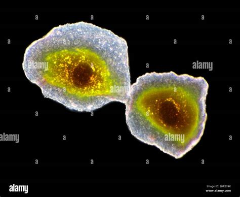 Human epithelial cells microscopy hi-res stock photography and images ...