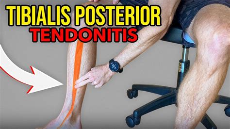 3 Exercises for Tibialis Posterior Tendonitis - YouTube