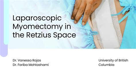 [VIDEO] Laparoscopic Myomectomy in the Retzius Space