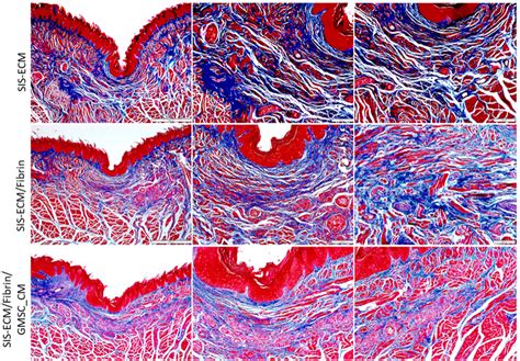 Beyond Free Flaps: The Promising Role of GMSC-Derived Extracellular ...