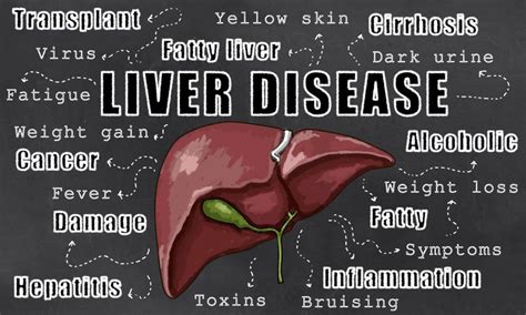 Prevention Of Liver Cancer: Overview, Causes, Symptoms, Treatment ...