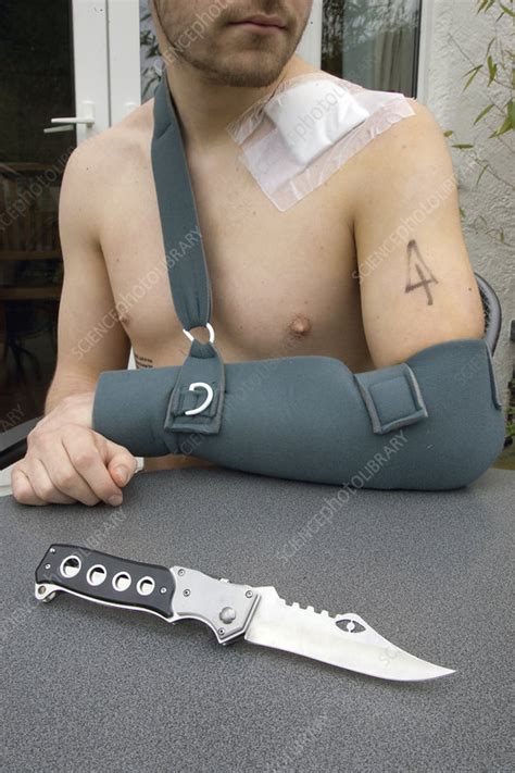 Youth knife crime victim - Stock Image - C049/4843 - Science Photo Library