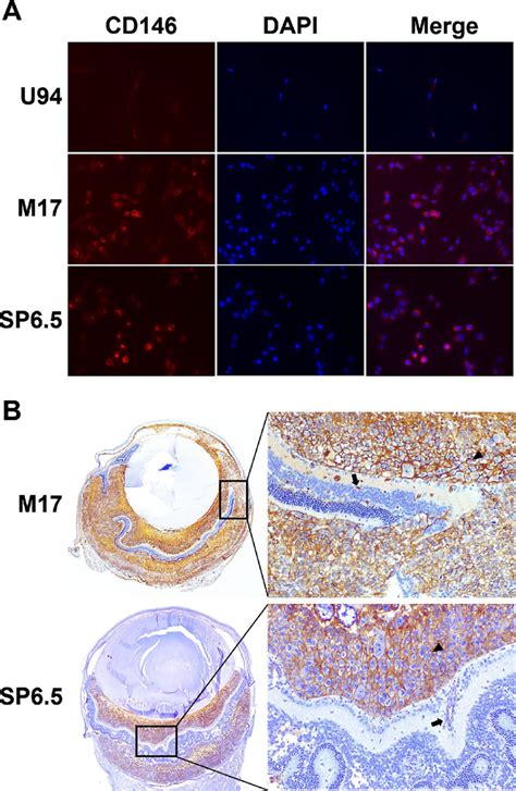 CD146 is highly expressed in uveal melanoma cells. (A) CD146 expression... | Download Scientific ...