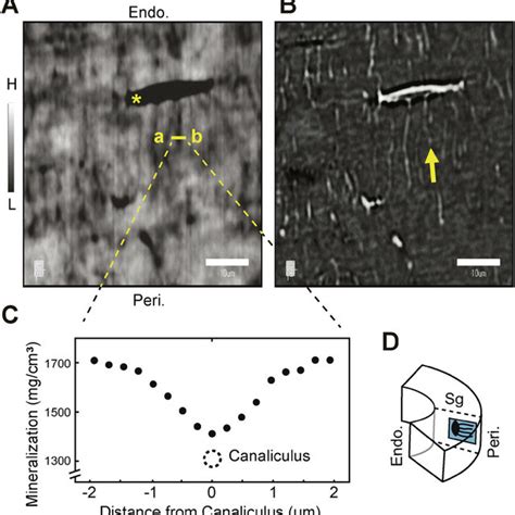 The lacuno-canalicular-bone canal network. Osteocyte canaliculi are... | Download Scientific Diagram