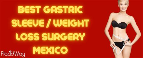 Best Gastric Sleeve Mexico - Top 7 Clinics for Weight loss