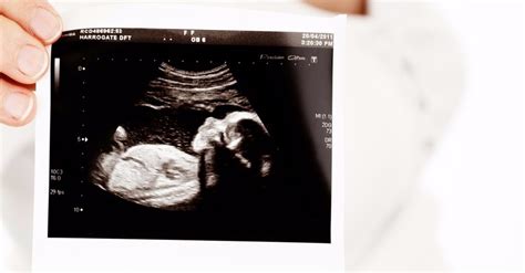 'Babies in the Womb': NBC's Today Surprises Pro-Lifers with 3D Ultrasound Story - Michael Foust