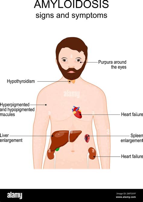 Liver Cirrhosis Symptoms Skin